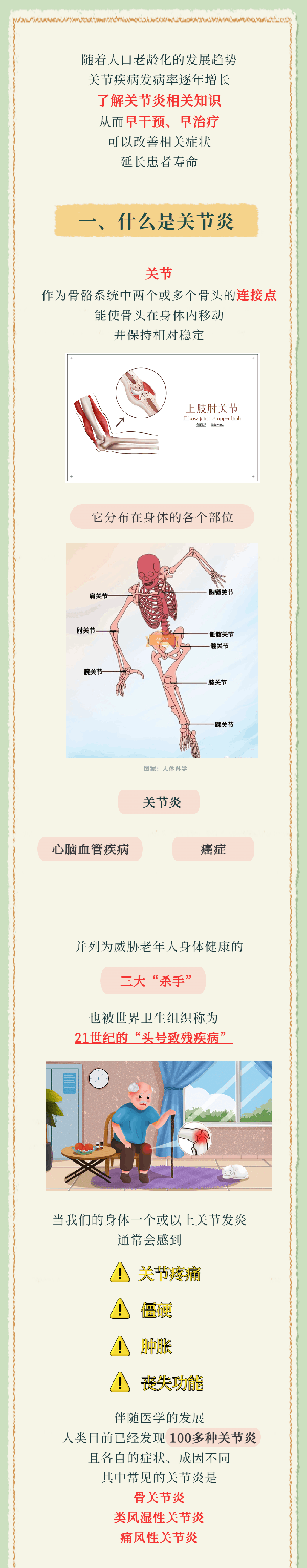 年纪大了，怎么预防关节炎？教你几招！