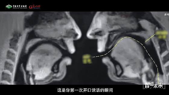 【智造未来】高磁建场 医影革新——超高场全身临床成像技术