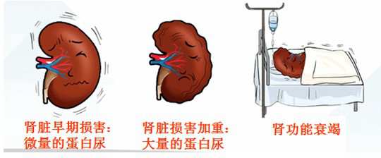 【对话科学家】“胖子”们要小心了！你们患肾病的风险增加了83%