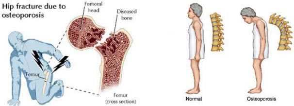 即将上天的这项实验 有望为近2亿中国人的健康带来福音 即将上天的这项实验 有望为近2亿中国人的健康带来福音