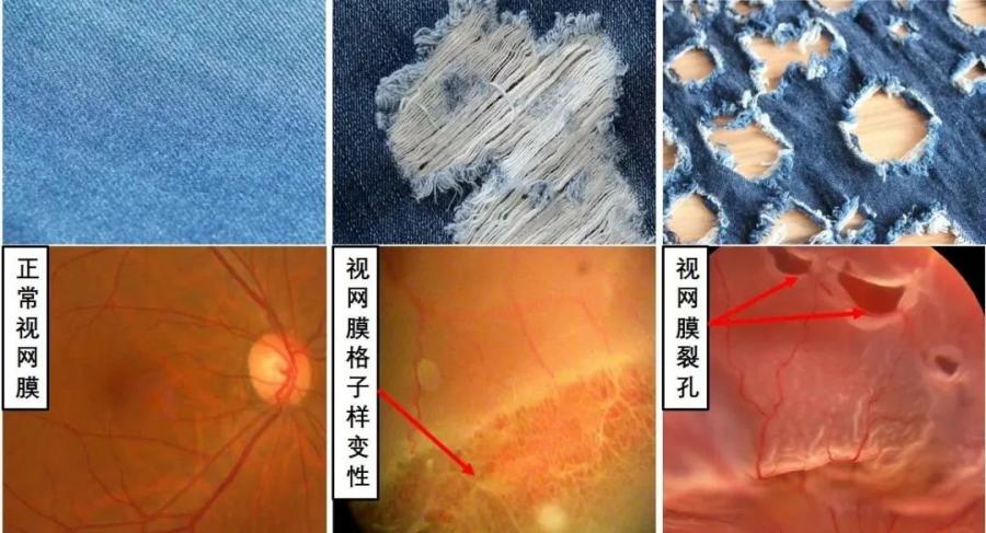 警惕！别让心灵的窗户“破洞”