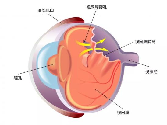 警惕！别让心灵的窗户“破洞”
