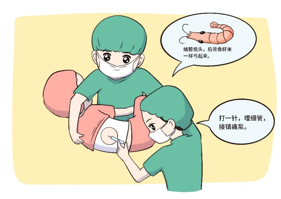 舒适又安全！别再妖魔化无痛分娩