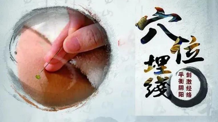 穴位埋线减重——助您轻松享“瘦”