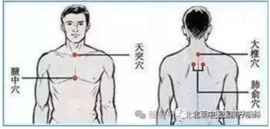 咳喘、关节痛、总怕冷？三伏贴的关键知识都在这