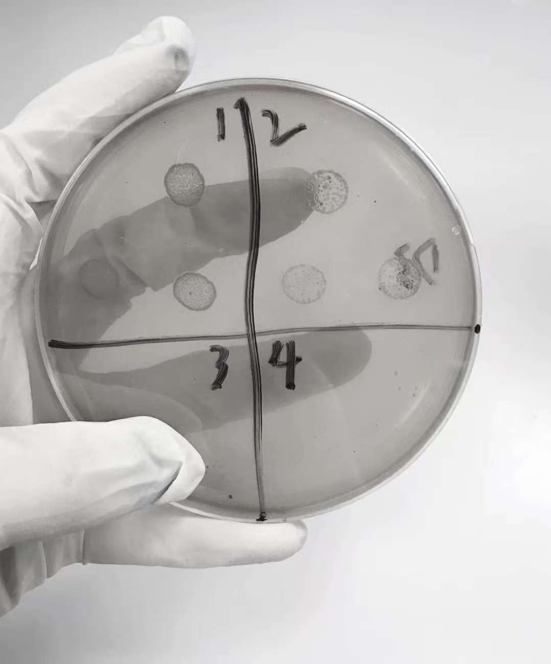 【大国粮策】喝凉水都长胖？减肥的秘密，竟然藏在肠道里