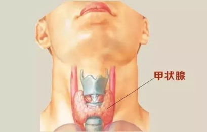 别emo了！警惕甲状腺疾病 | 世界卫生日