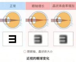 眼干眼涩眼疲劳？这份护眼攻略请收好！