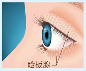 眼干眼涩眼疲劳？这份护眼攻略请收好！