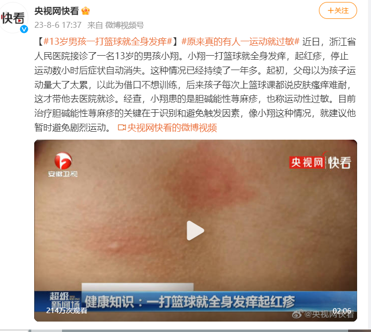 有些人不运动真的不是因为懒!而是真的对运动过敏