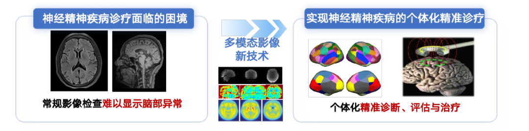 发明创业奖项目奖｜不用开颅，无需麻醉：神经调控新技术为患者带来福音！