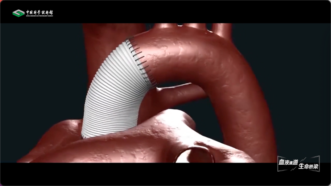 【智造未来】血液通道 生命桥梁——人造血管研发技术