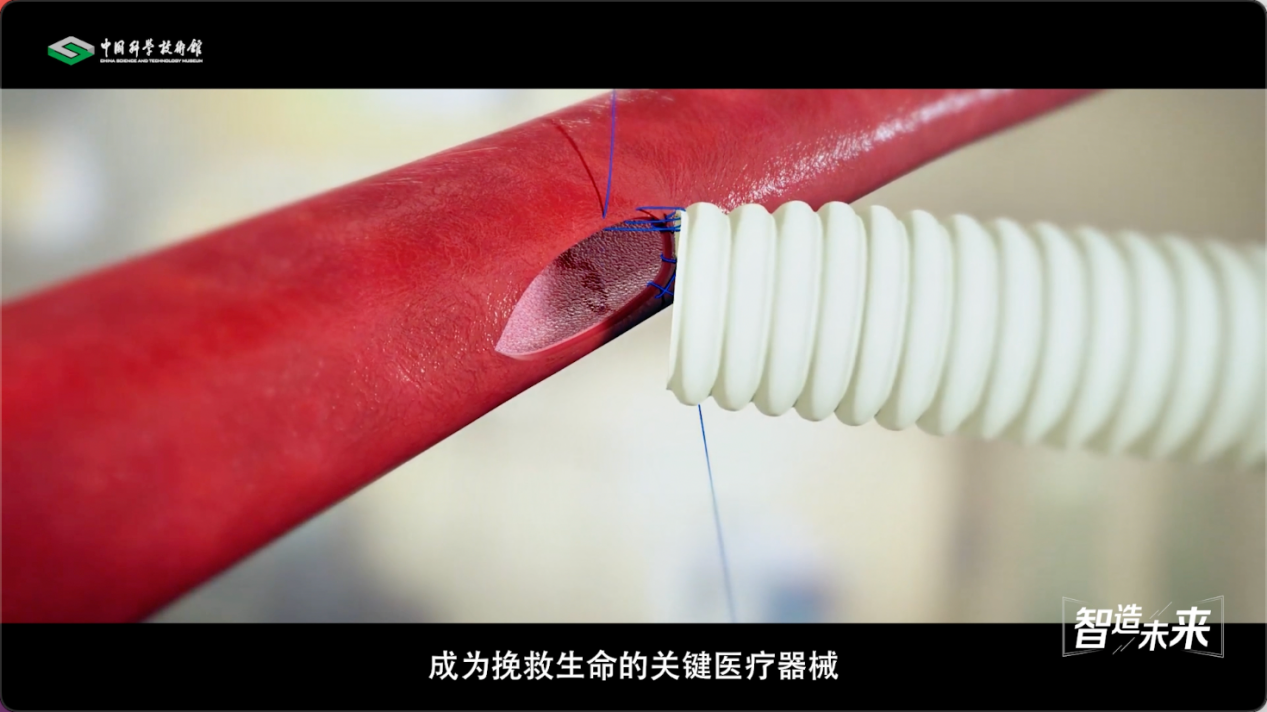 【智造未来】血液通道 生命桥梁——人造血管研发技术